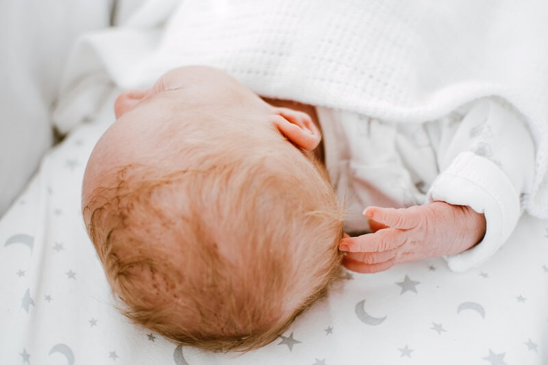 Cuidados del bebé: costra láctea o dermatitis seborreica